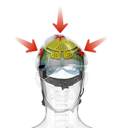 MIPS® BRAIN PROTECTION SYSTEM